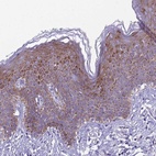 Anti-TRIM51 Antibody