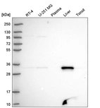 Western blot analysis in human cell line RT-4, human cell line U-251 MG, human plasma, human liver tissue and human tonsil tissue.