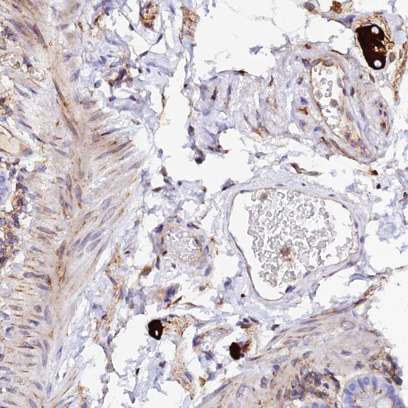 Anti-TRPV2 Antibody