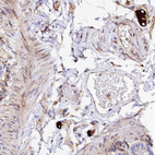 Anti-TRPV2 Antibody