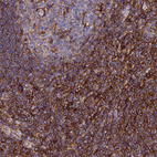 Immunohistochemical staining of human tonsil shows strong cytoplasmic positivity in non-germinal center cells.