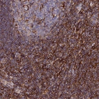 Immunohistochemical staining of human tonsil shows strong cytoplasmic positivity in non-germinal center cells.