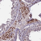 Immunohistochemical staining of human testis shows strong nuclear positivity in Leydig cells.