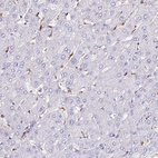Immunohistochemical staining of human liver shows no positivity in hepatocytes as expected.