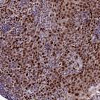 Anti-ZNF707 Antibody