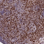 Immunohistochemical staining of human tonsil shows strong nuclear positivity in non-germinal center cells.