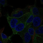 Immunofluorescent staining of human cell line SK-MEL-30 shows localization to plasma membrane.