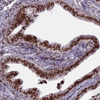 Immunohistochemical staining of human fallopian tube shows strong nuclear positivity in glandular cells.
