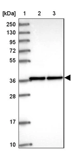 Lane 1: Marker [kDa] 250, 130, 95, 72, 55, 36, 28, 17, 10_br/_Lane 2: Human cell line RT-4_br/_Lane 3: Human cell line U-251MG sp