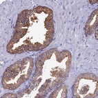Anti-TOMM20L Antibody