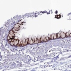 Anti-OR51Q1 Antibody