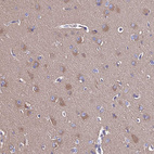 Anti-CALM1 Antibody