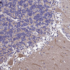 Anti-CALM1 Antibody