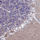 Immunohistochemical staining of human cerebellum shows weak cytoplasmic positivity in Purkinje cells.