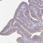 Anti-CALM1 Antibody