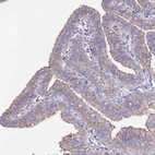 Immunohistochemical staining of human fallopian tube shows weak cytoplasmic positivity in glandular cells.