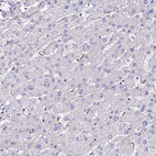 Immunohistochemical staining of human liver shows no positivity in hepatocytes as expected.