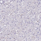 Immunohistochemical staining of human liver shows no positivity in hepatocytes as expected.