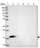 Lane 1: Marker [kDa] 250, 130, 95, 72, 55, 36, 28, 17, 10_br/_Lane 2: Human cell line RT-4_br/_Lane 3: Human cell line U-251MG sp_br/_Lane 4: Human plasma (IgG/HSA depleted)_br/_Lane 5: Human liver tissue_br/_Lane 6: Human tonsil tissue