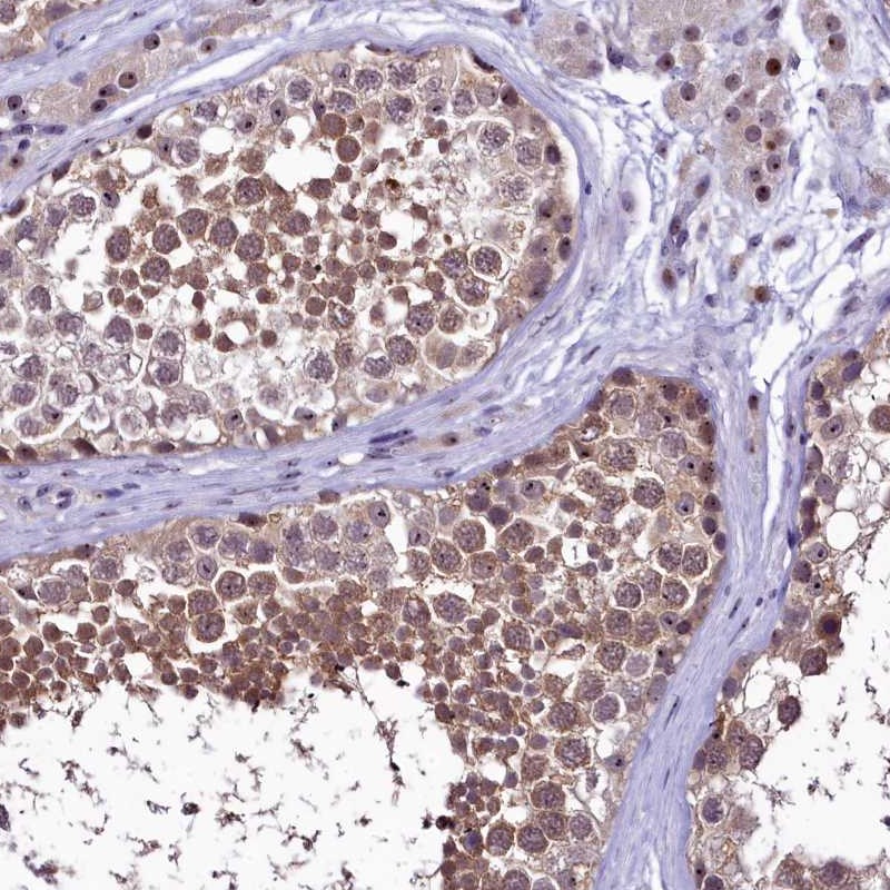 Anti-PRNT Antibody
