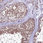 Anti-PRNT Antibody