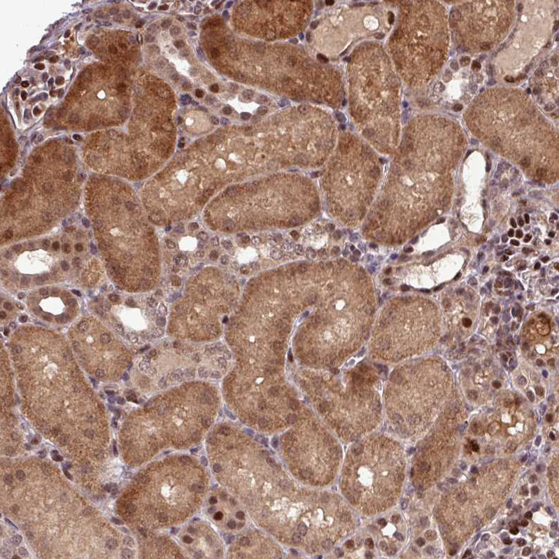Anti-SLC22A24 Antibody