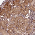 Anti-SLC22A24 Antibody