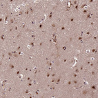 Immunohistochemical staining of human cerebral cortex shows moderate nuclear positivity in neurons.