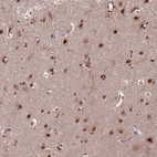 Immunohistochemical staining of human cerebral cortex shows moderate nuclear positivity in neurons.