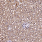 Immunohistochemical staining of human liver shows weak cytoplasmic positivity in hepatocytes.