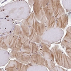 Immunohistochemical staining of human skeletal muscle shows weak cytoplasmic positivity in myocytes.