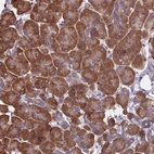 Anti-KIAA1143 Antibody