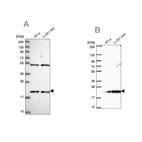 Anti-KIAA1143 Antibody