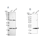 Western blot analysis using Anti-KIAA1143 antibody HPA045018 (A) shows similar pattern to independent antibody HPA061799 (B).