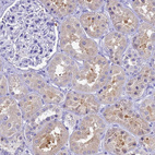 Immunohistochemical staining of human kidney weak cytoplasmic positivity in cells in tubules.