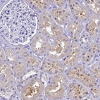 Immunohistochemical staining of human kidney weak cytoplasmic positivity in cells in tubules.