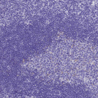 Immunohistochemical staining of human tonsil shows no positivity in germinal-center and non-germinal center cells as expected.