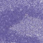 Immunohistochemical staining of human tonsil shows no positivity in germinal-center and non-germinal center cells as expected.