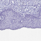 Immunohistochemical staining of human skin shows no positivity in squamous epithelial cells as expected.