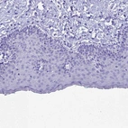 Immunohistochemical staining of human skin shows no positivity in squamous epithelial cells as expected.