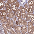 Anti-FZD8 Antibody