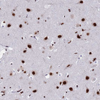 Anti-SF3B2 Antibody