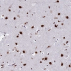 Immunohistochemical staining of human cerebral cortex shows strong nuclear positivity in neuronal cells.