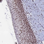 Immunohistochemical staining of human cervix, uterine shows strong nuclear positivity in squamous epithelial cells.