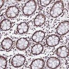 Immunohistochemical staining of human colon shows strong nuclear positivity in glandular cells.