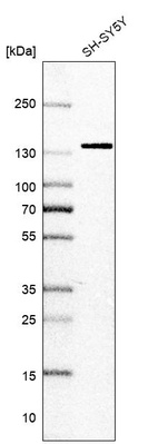 Anti-SF3B2 Antibody