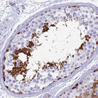 Immunohistochemical staining of human testis shows strong cytoplasmic positivity in cells in seminiferous ducts.