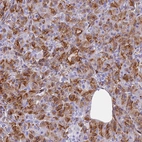 Immunohistochemical staining of human pancreas shows moderate cytoplasmic and membranous positivity in exocrine glandular cells.
