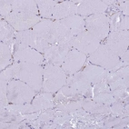Immunohistochemical staining of human skeletal muscle shows no positivity in myocytes as expected.