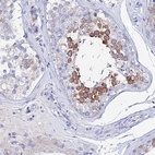 Anti-PTTG1 Antibody